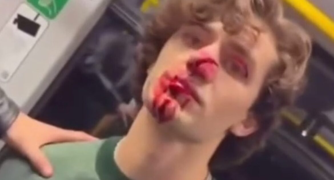 #