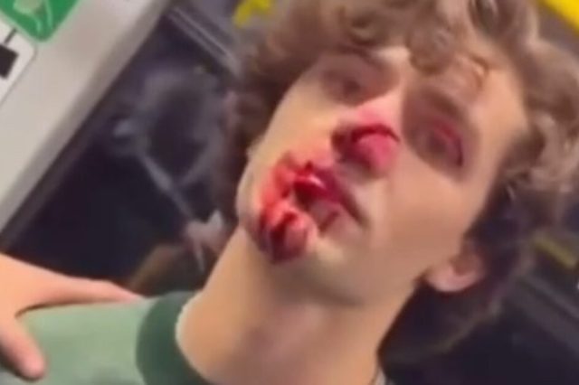 #